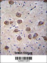 Anti-CTNND2 (C-term) Antibody