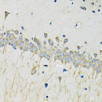 Anti-SERPINA4 Antibody