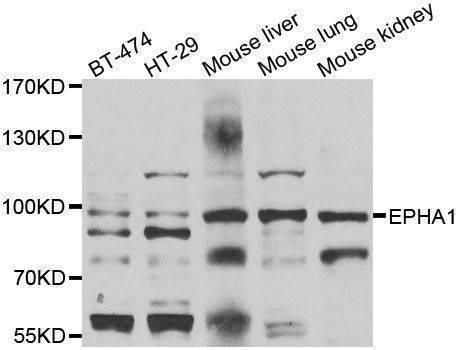 Anti-EPHA1 Antibody