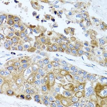 Anti-PEX14 Antibody