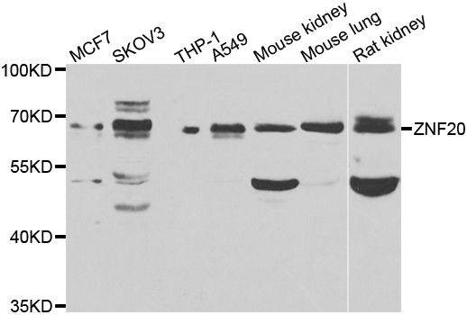 Anti-ZNF20 Antibody