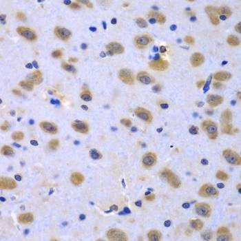Anti-CIAO1 Antibody