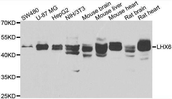 Anti-LHX6 Antibody