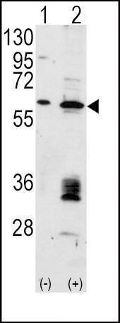 Anti-Mdm2 (C-term) Antibody