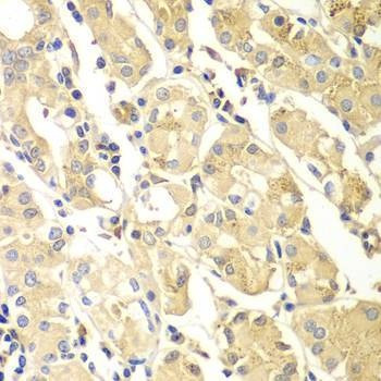 Anti-PDCD2L Antibody