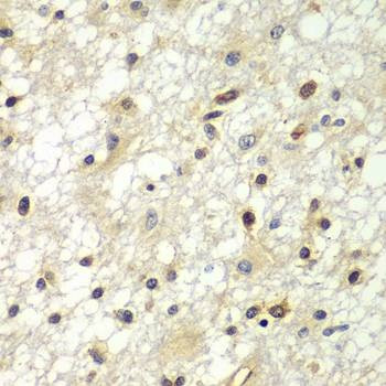 Anti-ZBTB48 Antibody