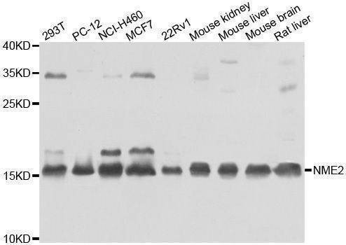 Anti-NME2 Antibody