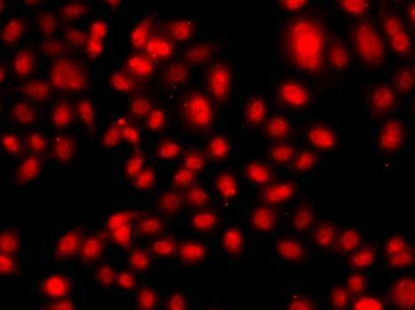 Anti-TEAD3 Antibody