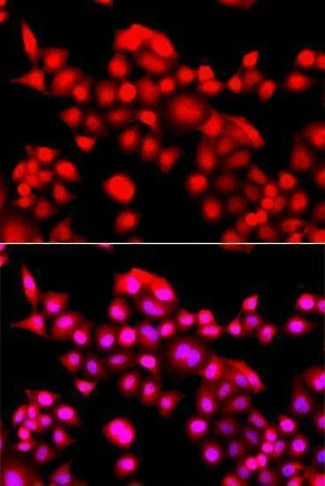 Anti-TEAD3 Antibody