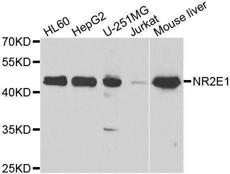 Anti-NR2E1 Antibody