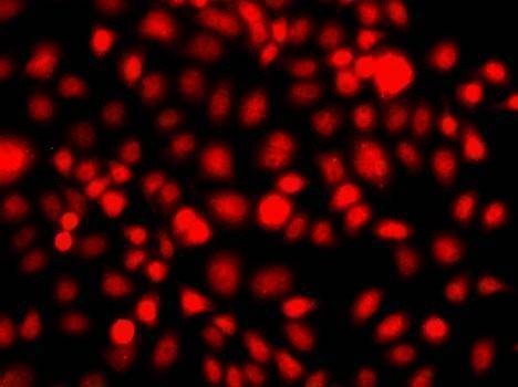 Anti-NR2E1 Antibody