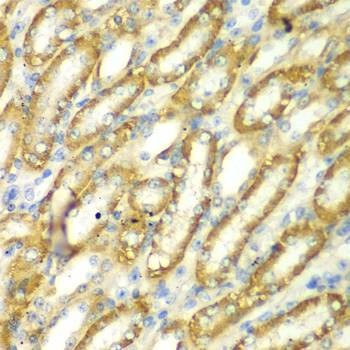 Anti-TM9SF1 Antibody