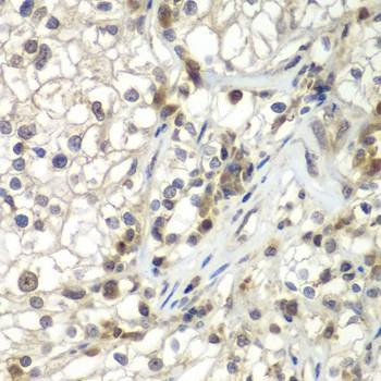 Anti-ASPSCR1 Antibody