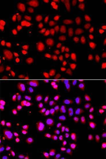 Anti-ASPSCR1 Antibody