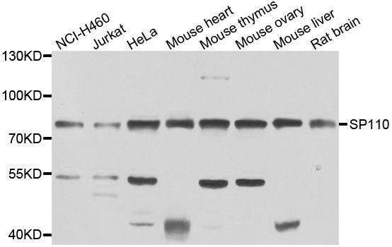 Anti-SP110 Antibody