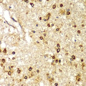 Anti-SMAD9 Antibody