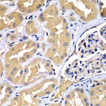 Anti-WIPI2 Antibody