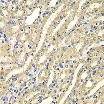 Anti-WIPI2 Antibody
