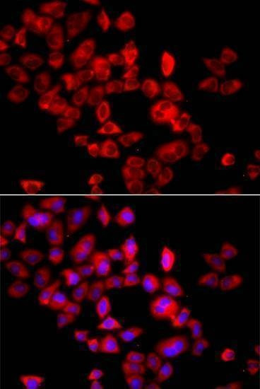 Anti-EIF4G1 Antibody