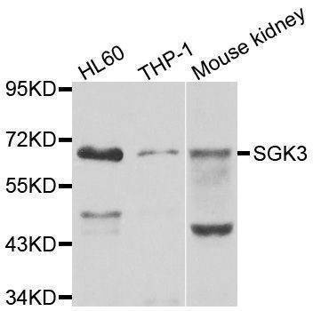 Anti-SGK3 Antibody