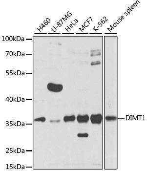 Anti-DIMT1 Antibody