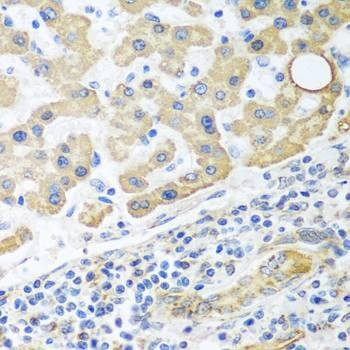 Anti-GLUD1 Antibody