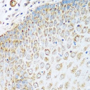 Anti-GLUD1 Antibody