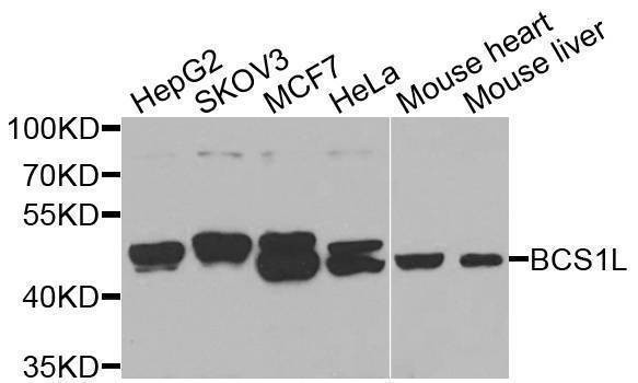 Anti-BCS1L Antibody
