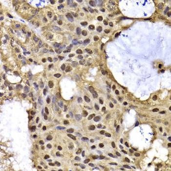 Anti-ARID3A Antibody