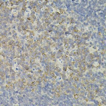 Anti-IRF1 Antibody