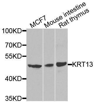 Anti-KRT13 Antibody