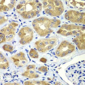 Anti-SHC1 Antibody