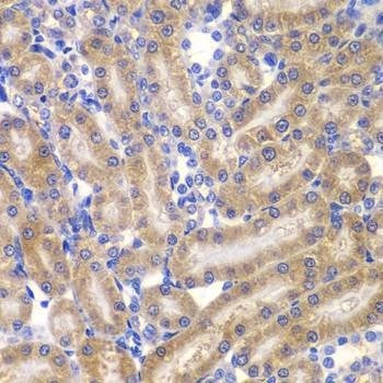 Anti-SHC1 Antibody