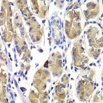 Anti-SHC1 Antibody