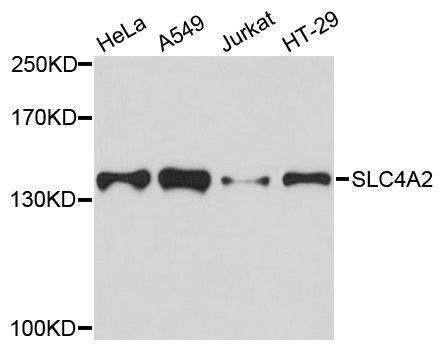 Anti-SLC4A2 Antibody