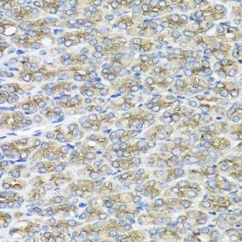 Anti-STXBP2 Antibody