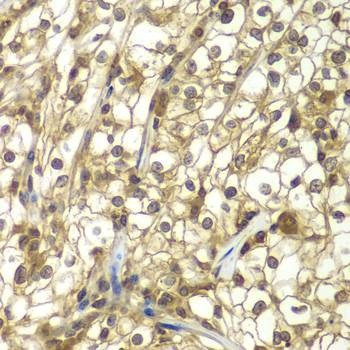 Anti-SULT2B1 Antibody