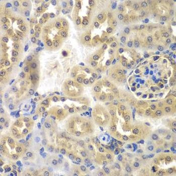 Anti-SULT2B1 Antibody