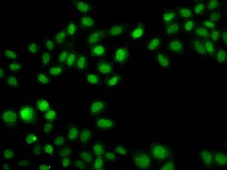 Anti-SULT2B1 Antibody