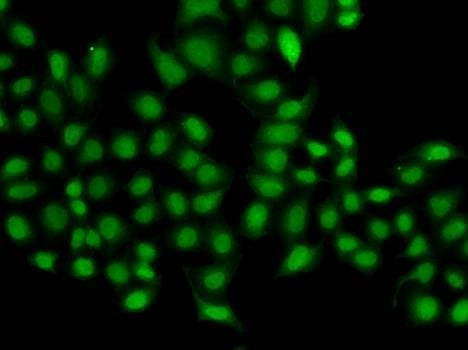 Anti-SULT2B1 Antibody