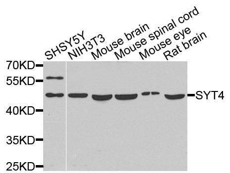 Anti-SYT4 Antibody