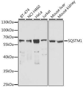 Anti-SQSTM1 Antibody