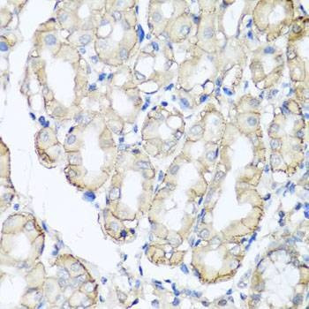 Anti-AHCYL1 Antibody