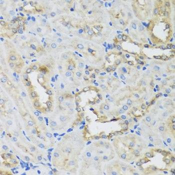 Anti-AHCYL1 Antibody