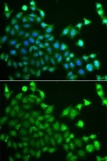 Anti-CBLC Antibody