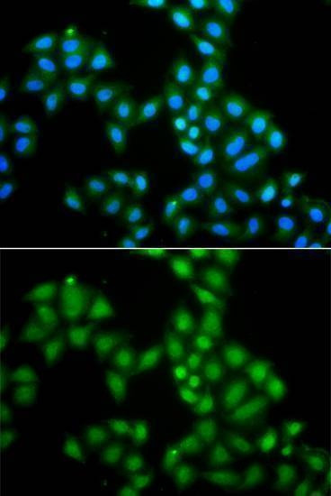 Anti-SAMHD1 Antibody