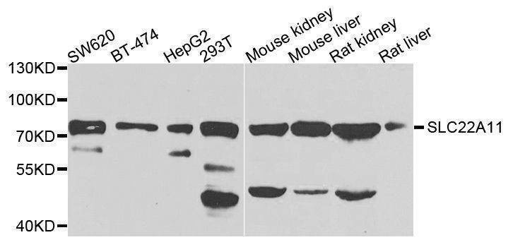 Anti-SLC22A11 Antibody