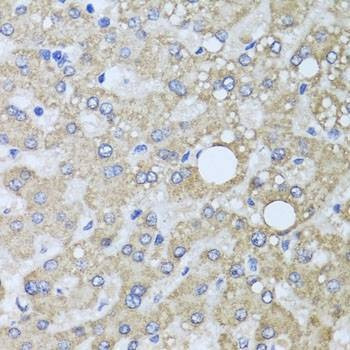 Anti-AARS2 Antibody