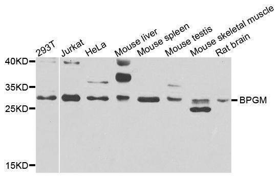 Anti-BPGM Antibody