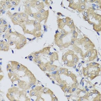 Anti-BPGM Antibody